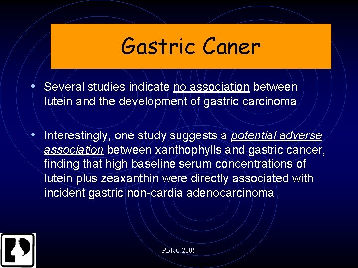 Gastric Caner • Several studies indicate no association between lutein and the development of