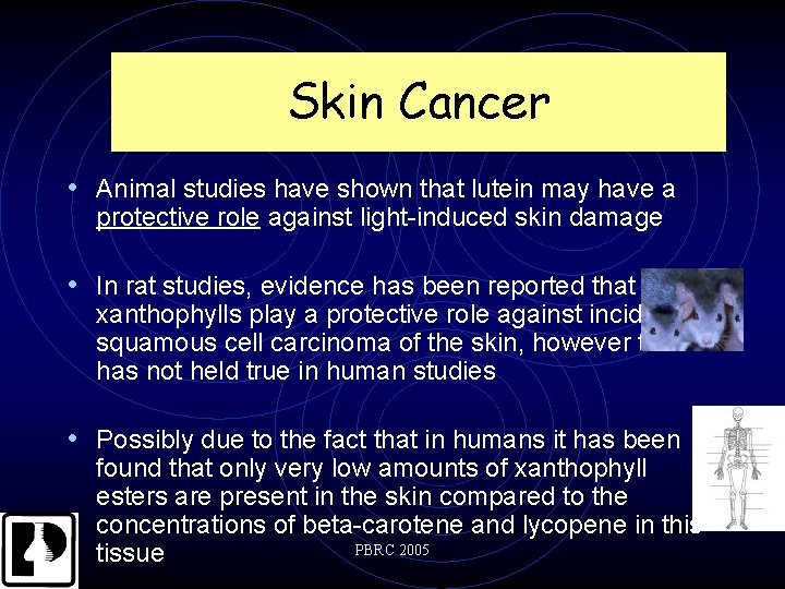 Skin Cancer • Animal studies have shown that lutein may have a protective role