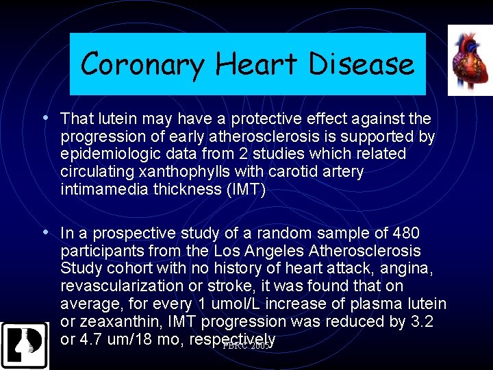 Coronary Heart Disease • That lutein may have a protective effect against the progression