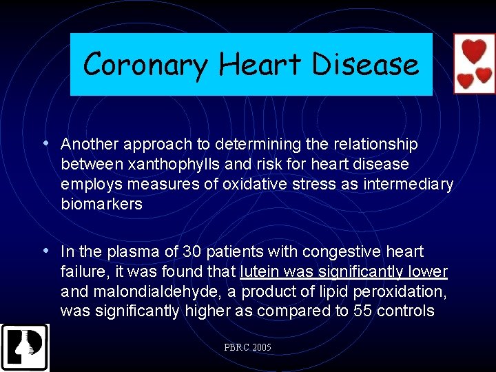 Coronary Heart Disease • Another approach to determining the relationship between xanthophylls and risk