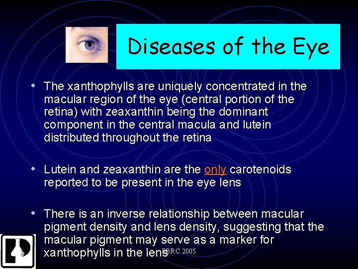 Diseases of the Eye • The xanthophylls are uniquely concentrated in the macular region
