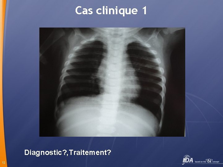 Cas clinique 1 Diagnostic? , Traitement? 12 