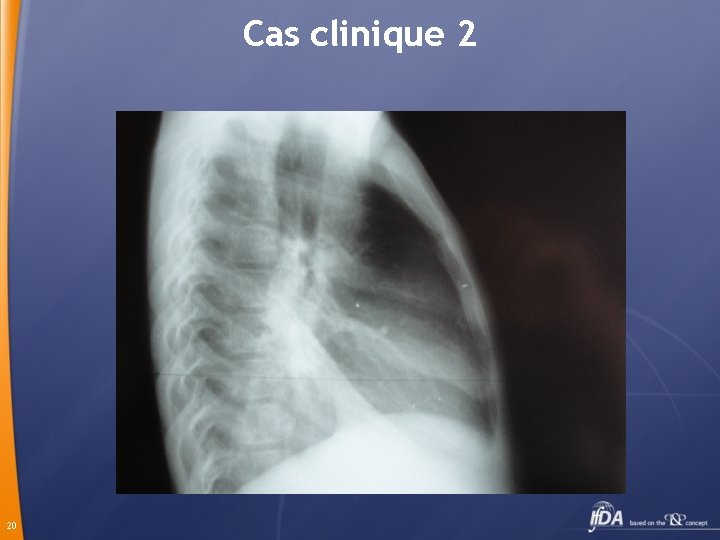 Cas clinique 2 20 