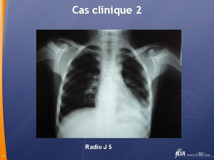 Cas clinique 2 Radio J 5 22 