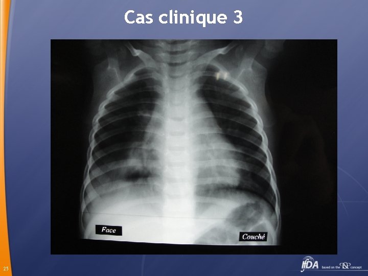 Cas clinique 3 25 