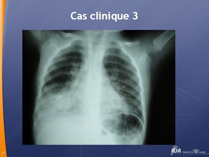 Cas clinique 3 27 