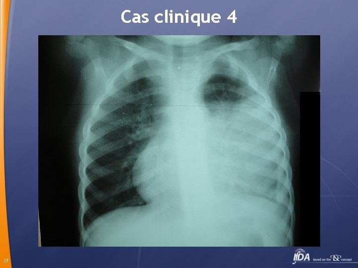 Cas clinique 4 37 