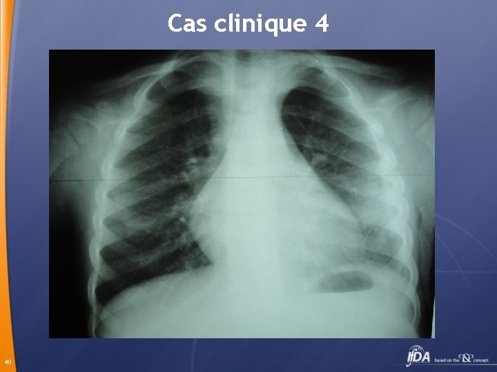 Cas clinique 4 40 