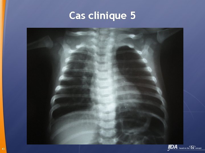 Cas clinique 5 43 