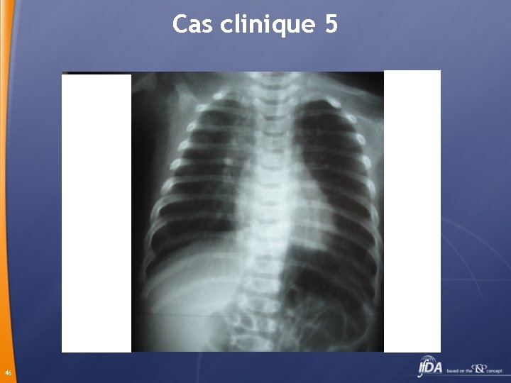 Cas clinique 5 46 