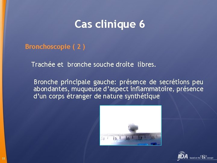 Cas clinique 6 Bronchoscopie ( 2 ) Trachée et bronche souche droite libres. Bronche