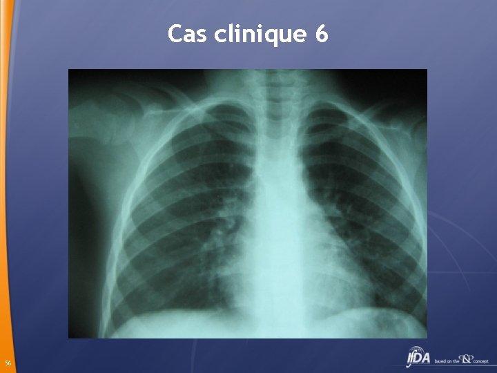 Cas clinique 6 56 