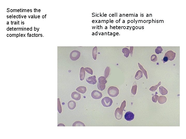 Sometimes the selective value of a trait is determined by complex factors. Sickle cell