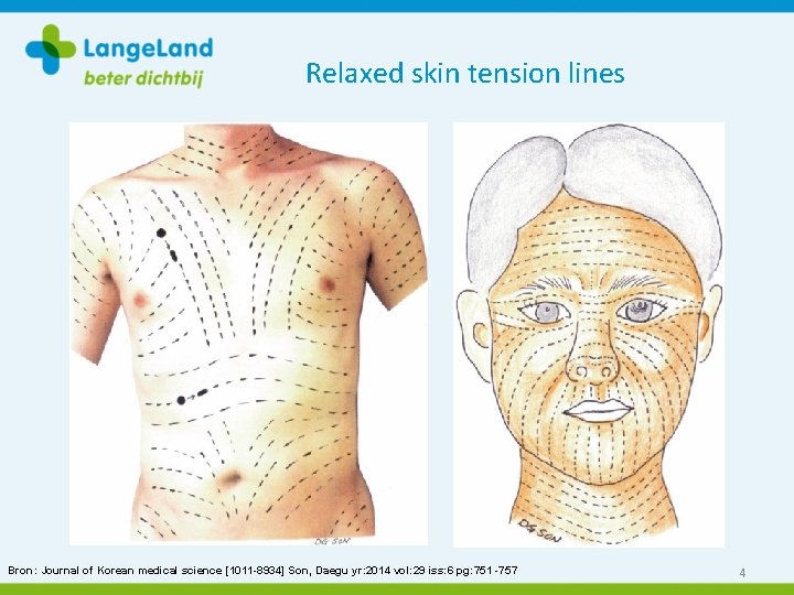 Relaxed skin tension lines Bron: Journal of Korean medical science [1011 -8934] Son, Daegu