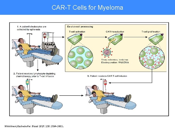 CAR-T Cells for Myeloma CAR-T Cells Therapy Mikkilineni, Kochederfer. Blood 2017: 130: 2594 -2602
