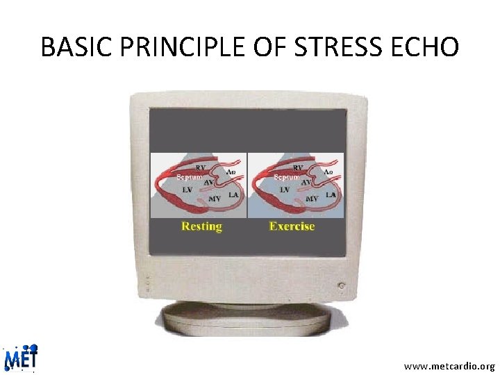 BASIC PRINCIPLE OF STRESS ECHO www. metcardio. org 