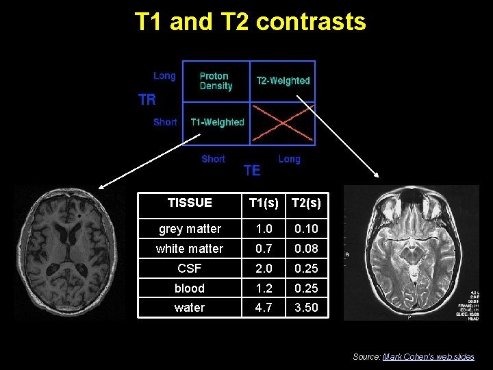 T 1 and T 2 contrasts TISSUE T 1(s) T 2(s) grey matter 1.