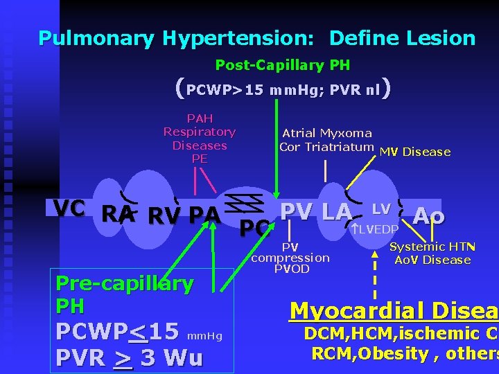  Pulmonary Hypertension: Define Lesion Post-Capillary PH (PCWP>15 mm. Hg; PVR nl) PAH Respiratory