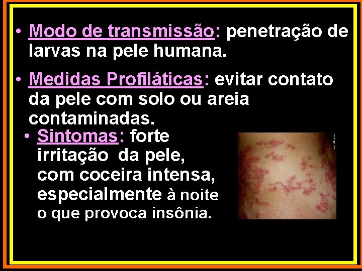  • Modo de transmissão: penetração de larvas na pele humana. • Medidas Profiláticas:
