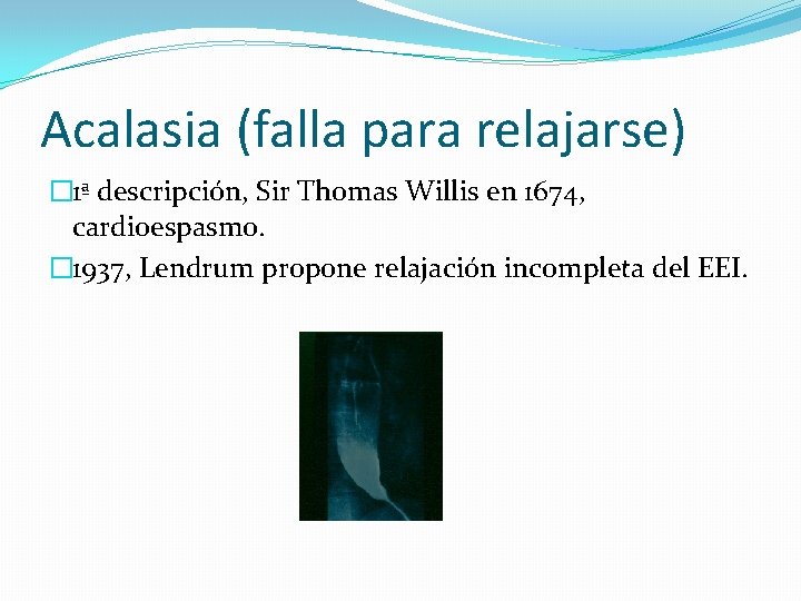 Acalasia (falla para relajarse) � 1ª descripción, Sir Thomas Willis en 1674, cardioespasmo. �