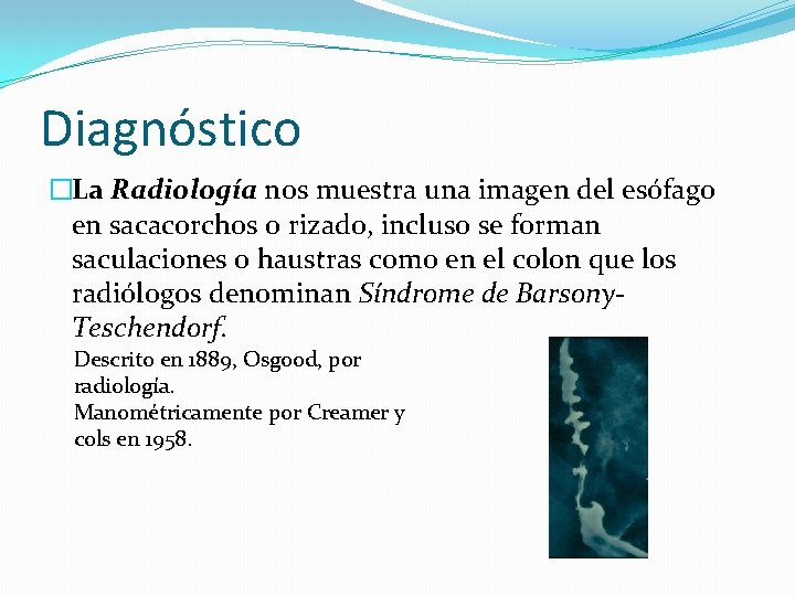Diagnóstico �La Radiología nos muestra una imagen del esófago en sacacorchos o rizado, incluso
