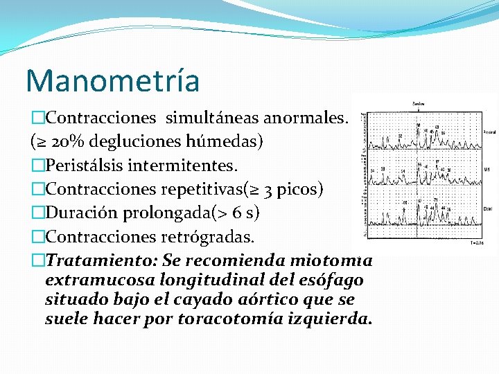 Manometría �Contracciones simultáneas anormales. (≥ 20% degluciones húmedas) �Peristálsis intermitentes. �Contracciones repetitivas(≥ 3 picos)