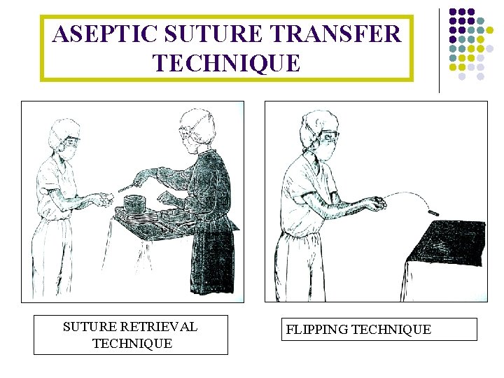 ASEPTIC SUTURE TRANSFER TECHNIQUE SUTURE RETRIEVAL TECHNIQUE FLIPPING TECHNIQUE 