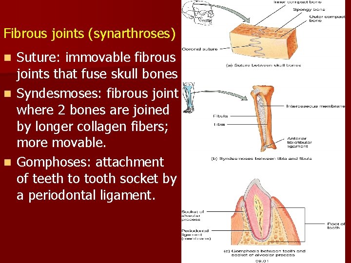 Fibrous joints (synarthroses) Suture: immovable fibrous joints that fuse skull bones n Syndesmoses: fibrous