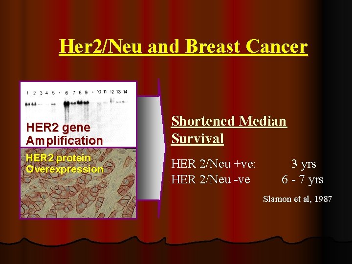 Her 2/Neu and Breast Cancer HER 2 gene Amplification HER 2 protein Overexpression Shortened