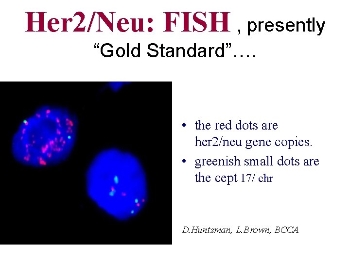 Her 2/Neu: FISH , presently “Gold Standard”…. • the red dots are her 2/neu