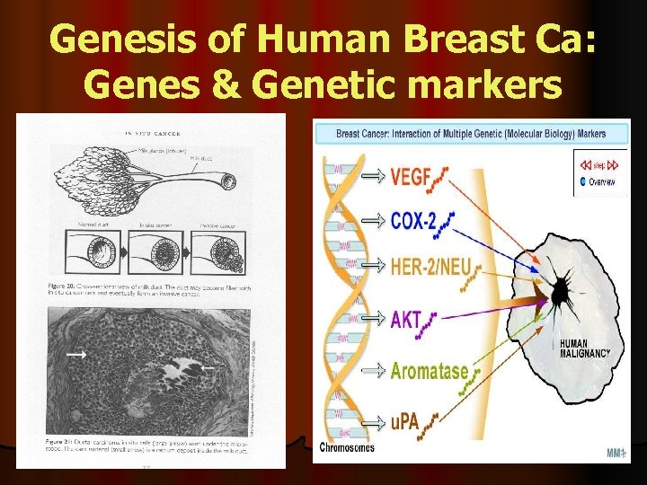 Genesis of Human Breast Ca: Genes & Genetic markers 