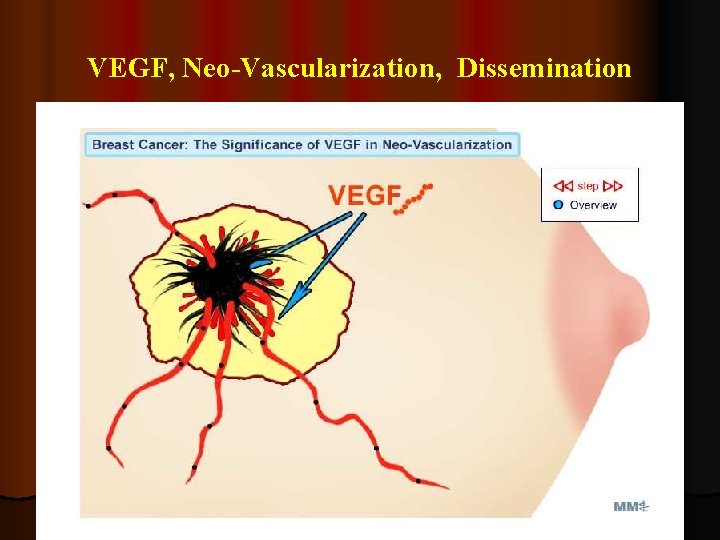 VEGF, Neo-Vascularization, Dissemination 