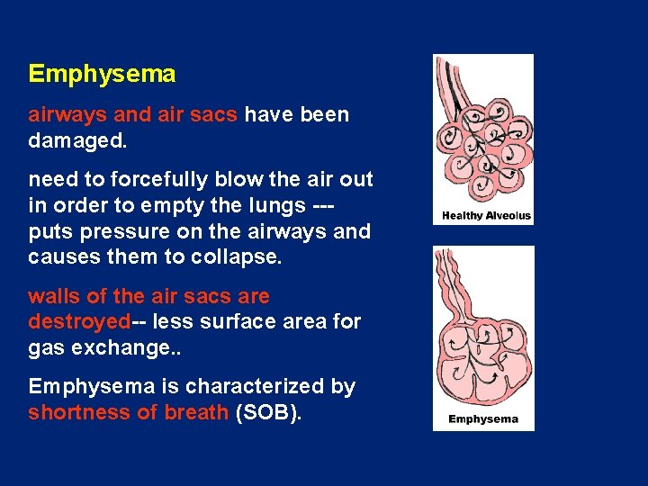 Emphysema airways and air sacs have been damaged. need to forcefully blow the air