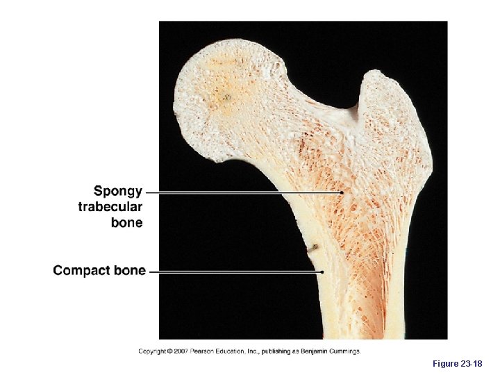 Figure 23 -18 