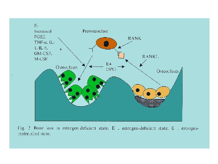 F. S. Mirza, K. M. Prestwood / Enocrinol Metab Clin N Am 33 (2004)