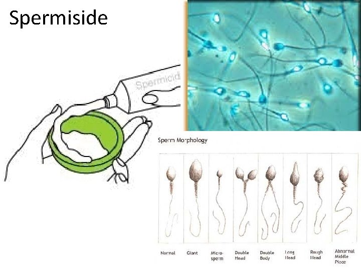 Spermiside 