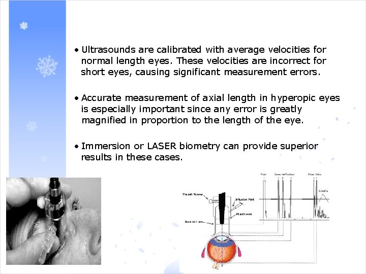  • Ultrasounds are calibrated with average velocities for normal length eyes. These velocities