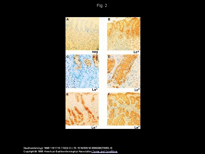 Fig. 2 Gastroenterology 1998 1151113 -1122 DOI: (10. 1016/S 0016 -5085(98)70082 -4) Copyright ©