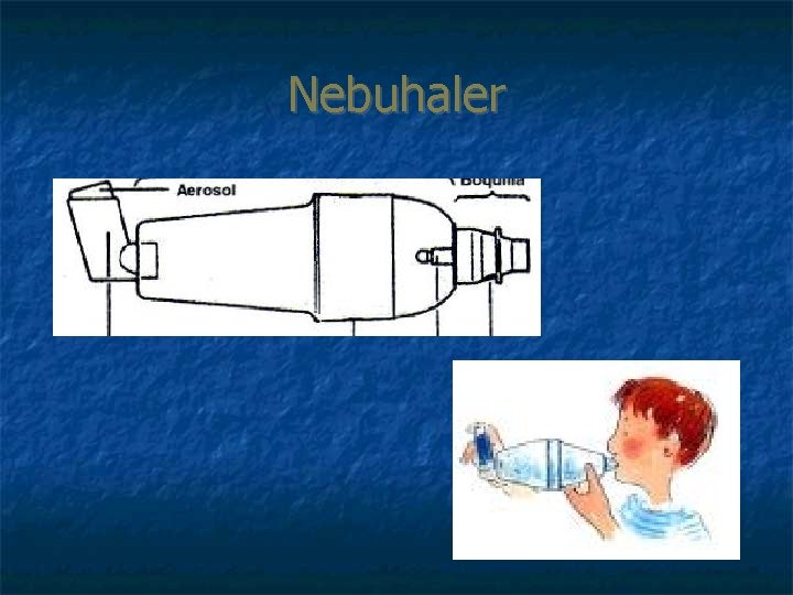 Nebuhaler 