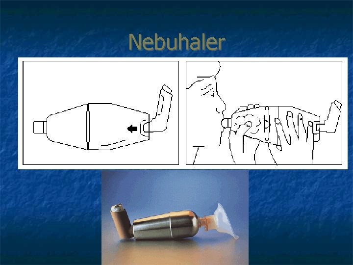 Nebuhaler 