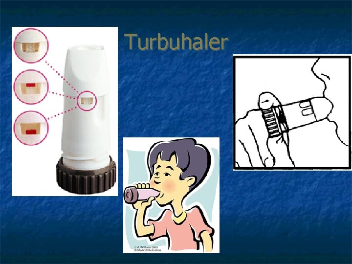 Turbuhaler 