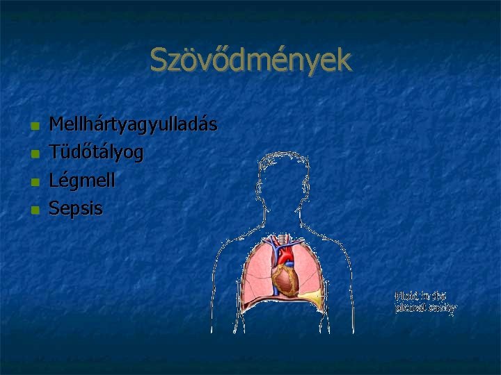 Szövődmények Mellhártyagyulladás Tüdőtályog Légmell Sepsis 