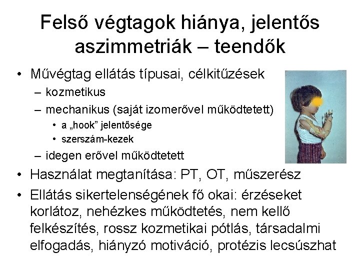 Felső végtagok hiánya, jelentős aszimmetriák – teendők • Művégtag ellátás típusai, célkitűzések – kozmetikus