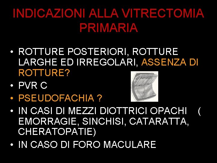 INDICAZIONI ALLA VITRECTOMIA PRIMARIA • ROTTURE POSTERIORI, ROTTURE LARGHE ED IRREGOLARI, ASSENZA DI ROTTURE?