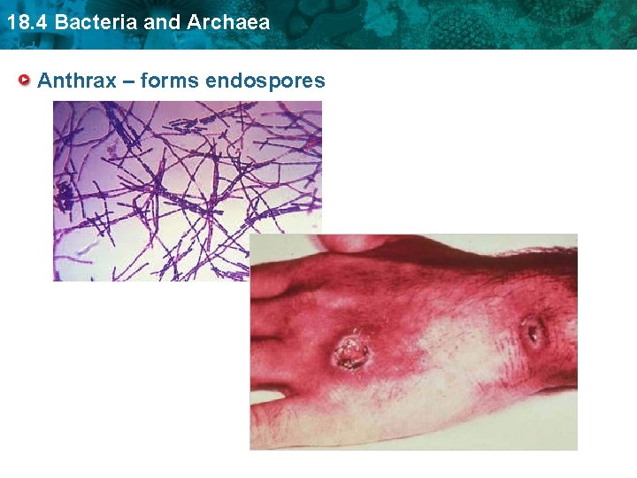18. 4 Bacteria and Archaea Anthrax – forms endospores 