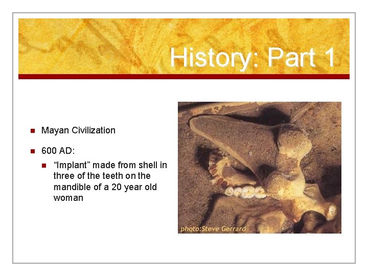 History: Part 1 n Mayan Civilization n 600 AD: n “Implant” made from shell