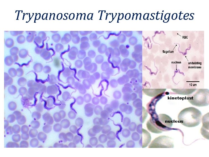 Trypanosoma Trypomastigotes 