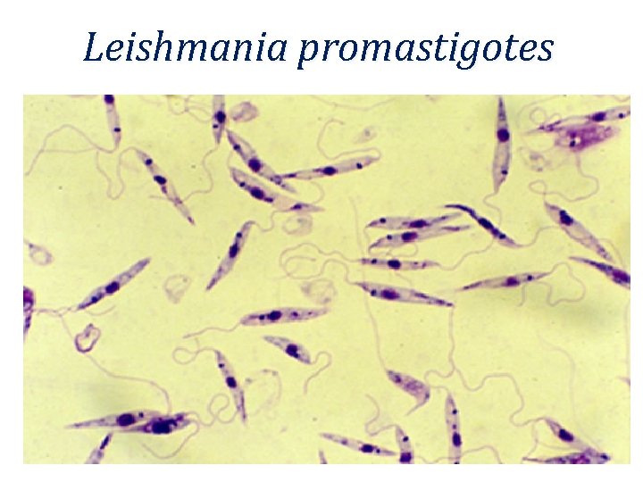 Leishmania promastigotes 