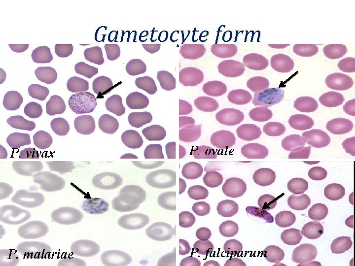 Gametocyte form P. vivax P. ovale P. malariae P. falciparum 
