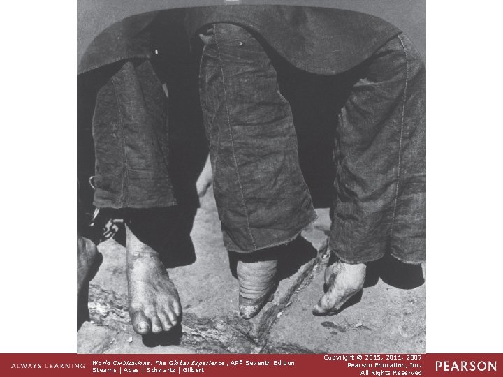 Footbinding as a Marker of Male Dominance As this photograph vividly illustrates, mature women